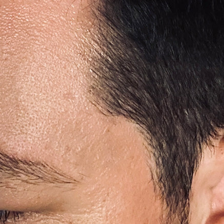 After