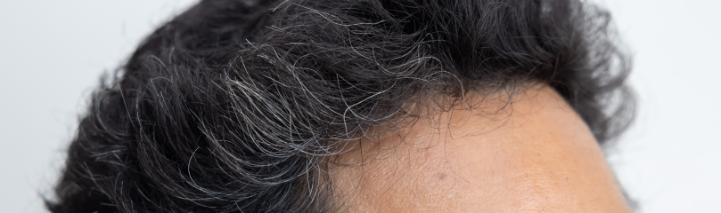 Gray Hair at 30? Understanding Premature Graying