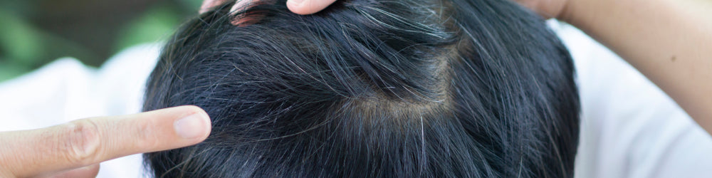 Is Gray Hair Reversible? What Scientific Studies Reveal