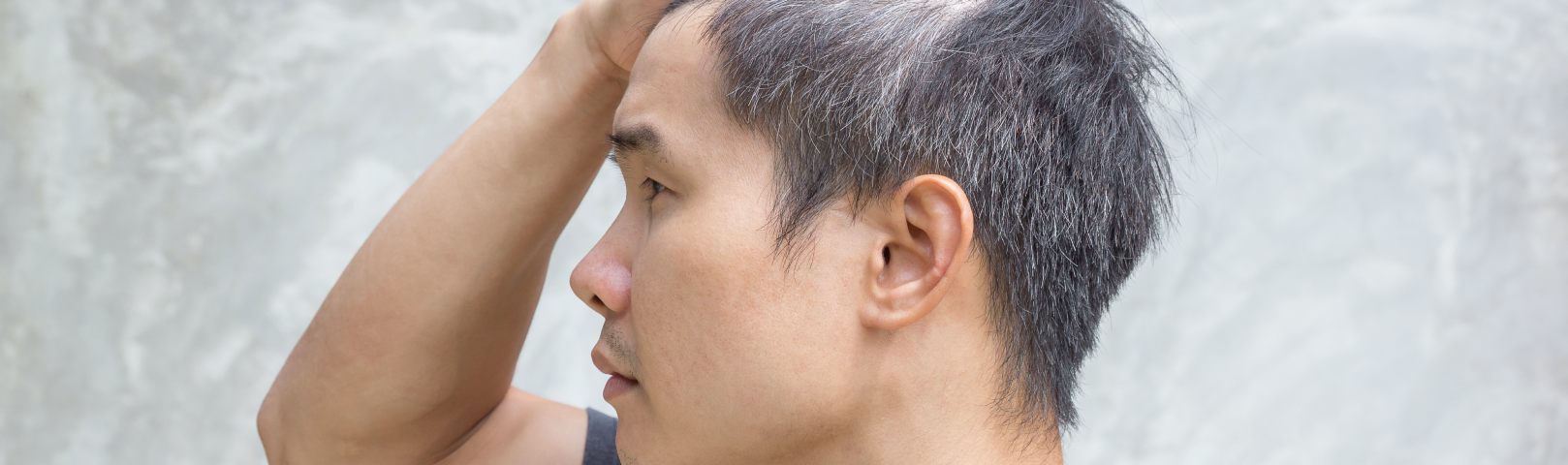 Gray Hair at 30? Understanding Premature Graying