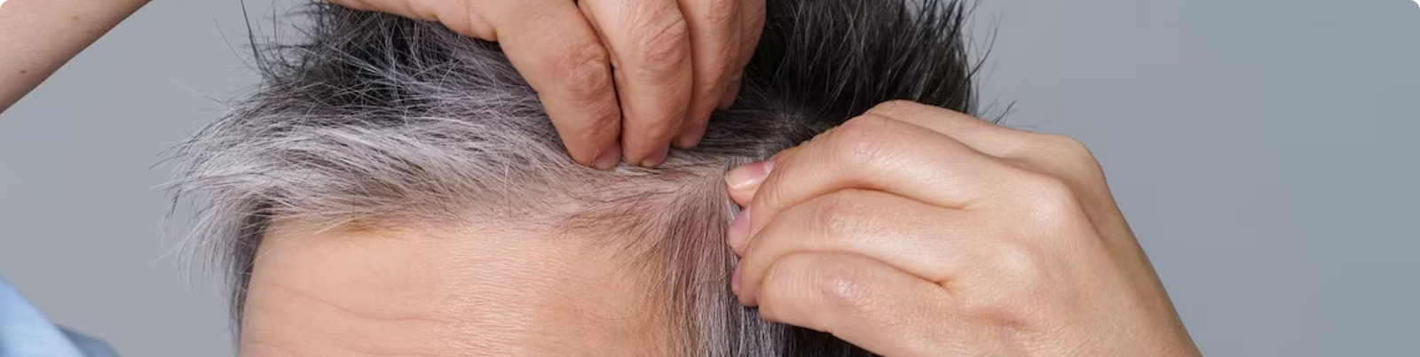 5 Essential Vitamins and Minerals for Healthy Hair